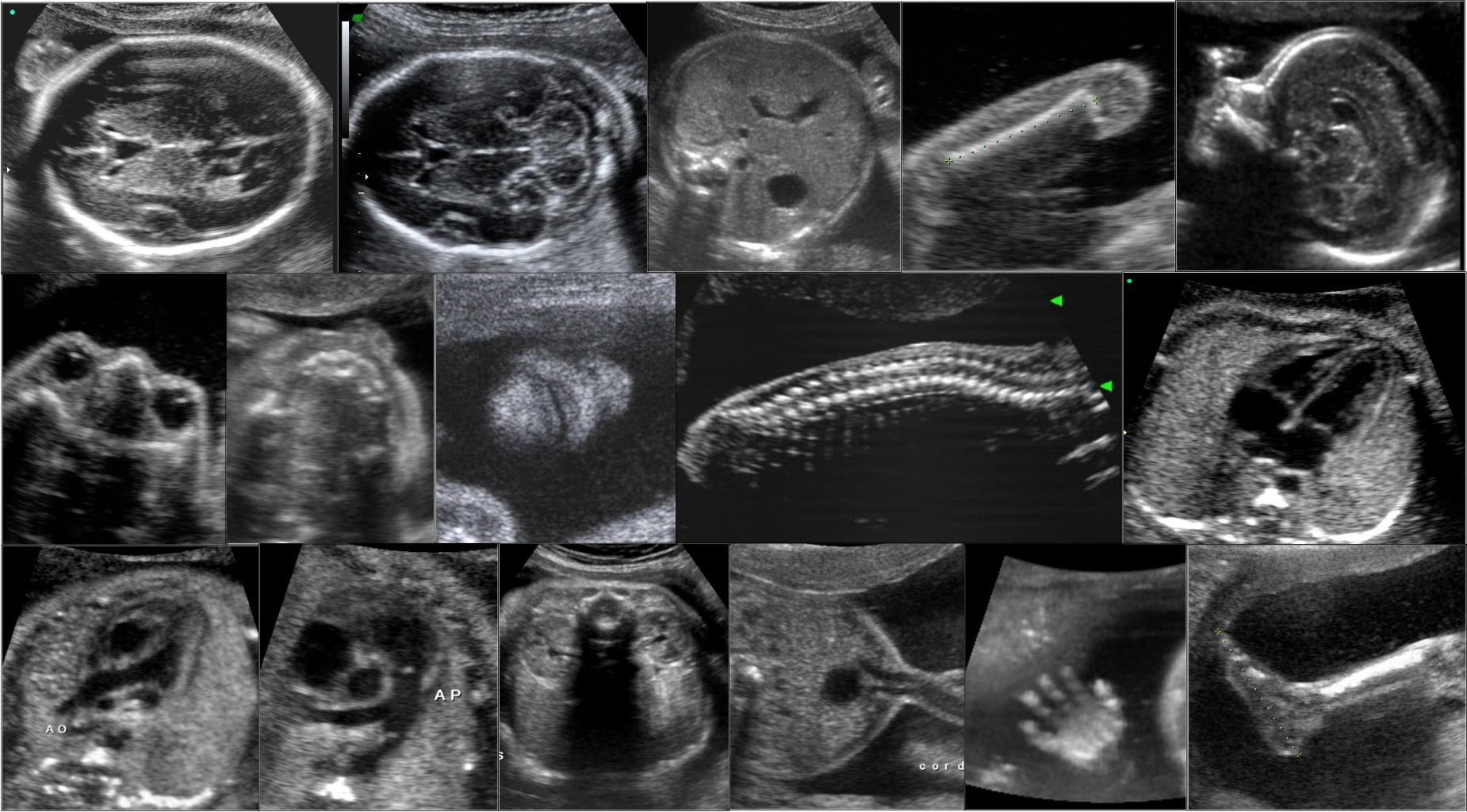 Medicina Fetal Clinica Imagem Med