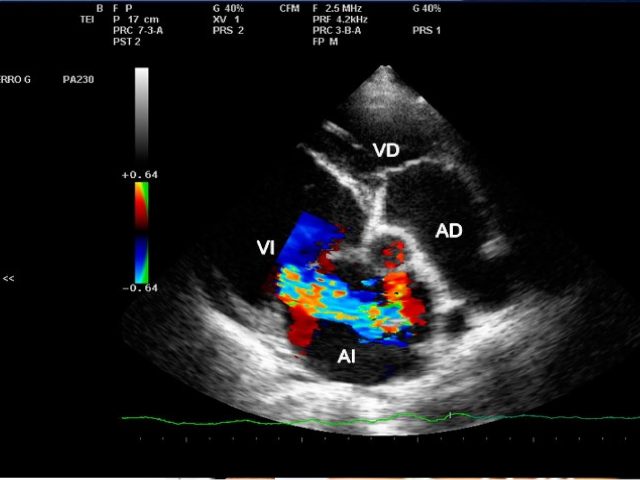 Ecocardiografia Bidimensional Com Doppler Clinica Imagem Med